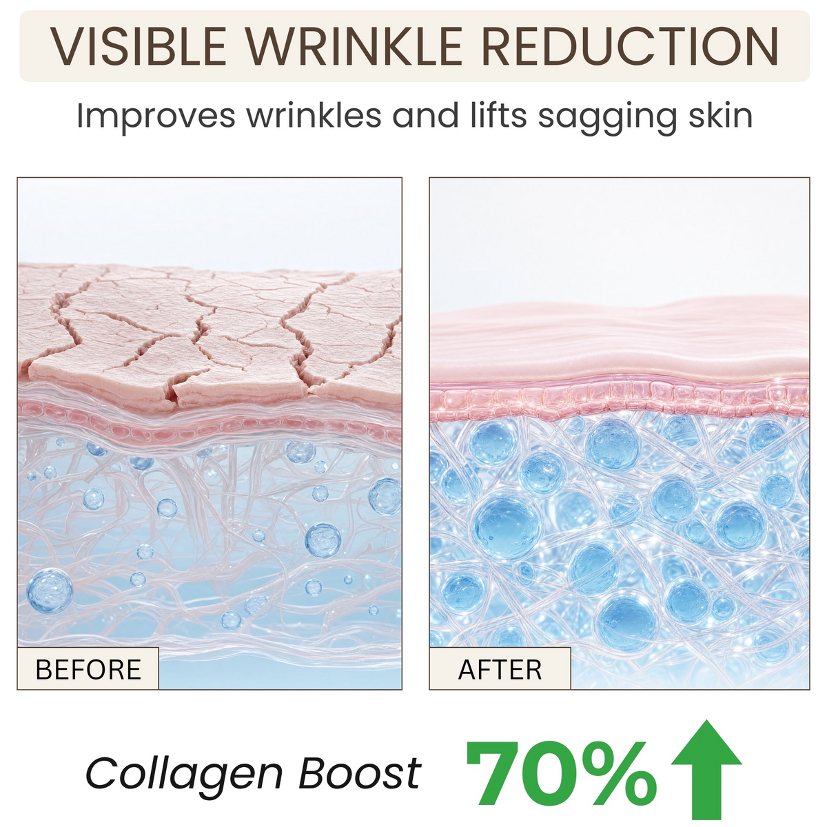 Skin elasticity skincare feature