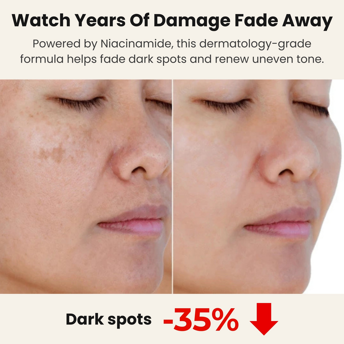 Uneven skin tone skincare feature