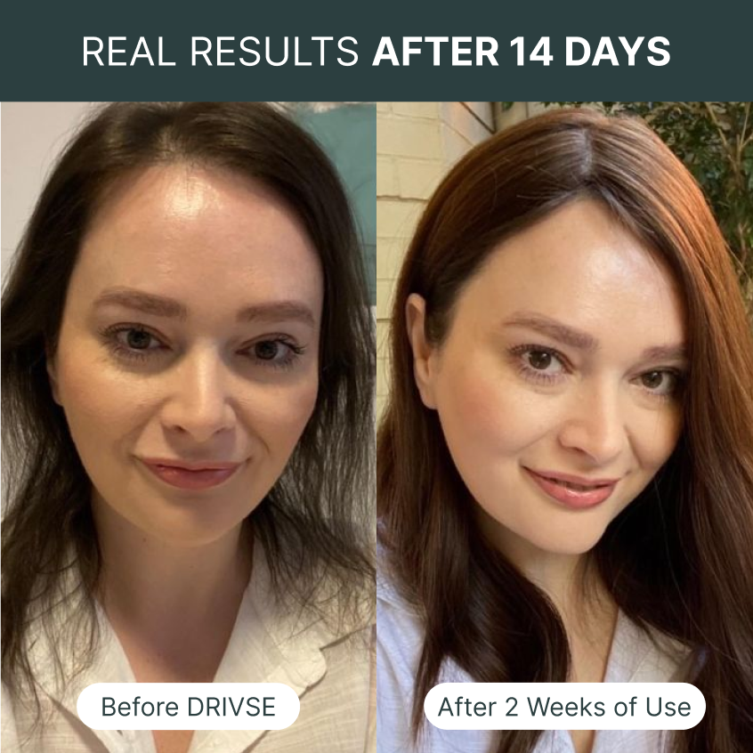 1755252572-Before_After_Examples_3_e66af46c-ac17-430b-a82e-8fd438eb9347.png