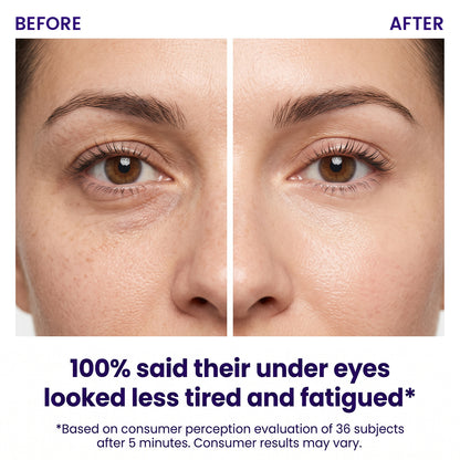 Instant Lift Eye Gel — Reduce the Look of Eye Bags in Minutes 🔥