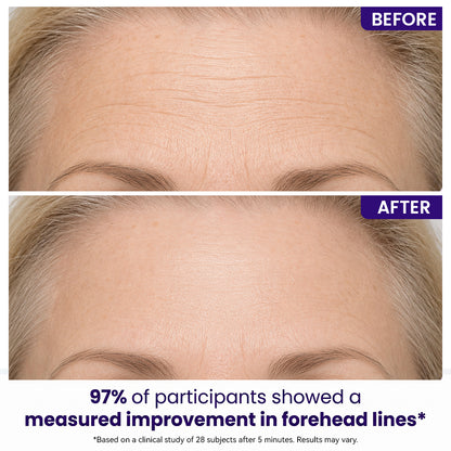 Instant Lift Eye Gel — Reduce the Look of Eye Bags in Minutes 🔥