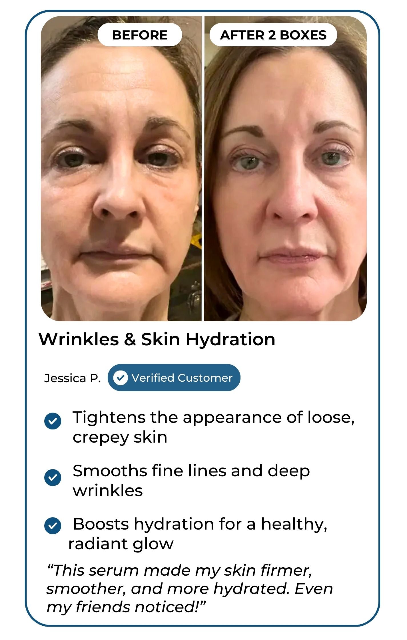 Wrinkles and skin hydration customer results