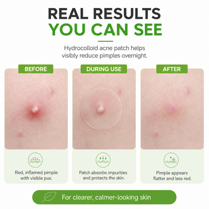Zero Fit Blemish & Dark Spot Patch Duo