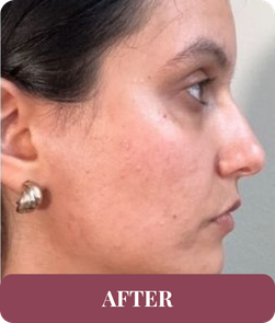 After treatment