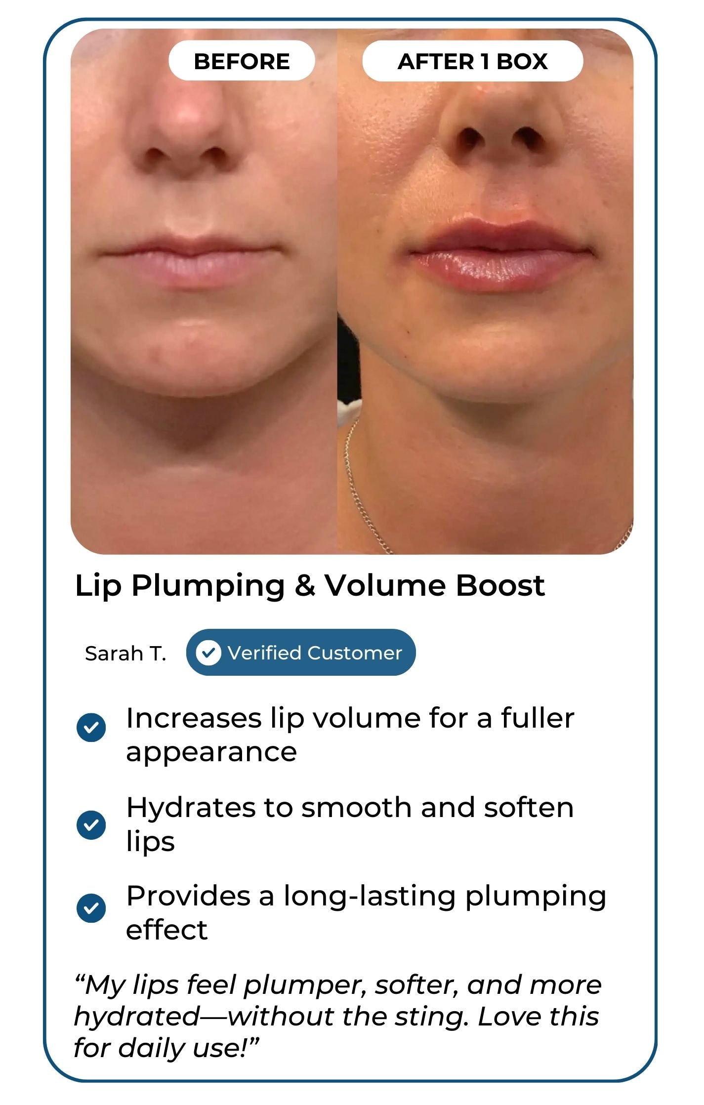 Lip plumping and volume customer results