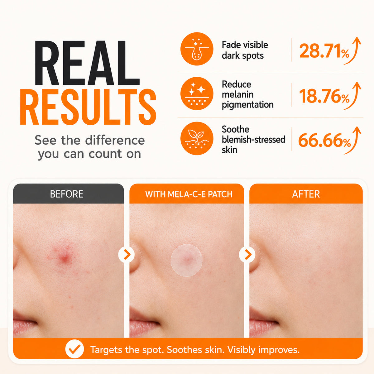 Zero Fit Blemish & Dark Spot Patch Duo