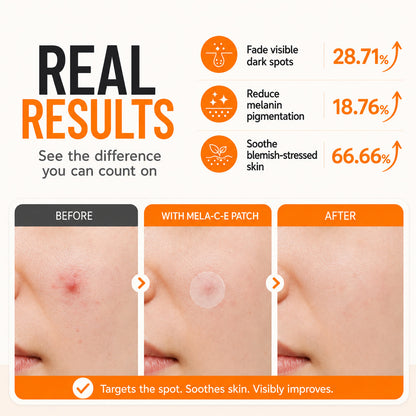 Zero Fit Blemish & Dark Spot Patch Duo