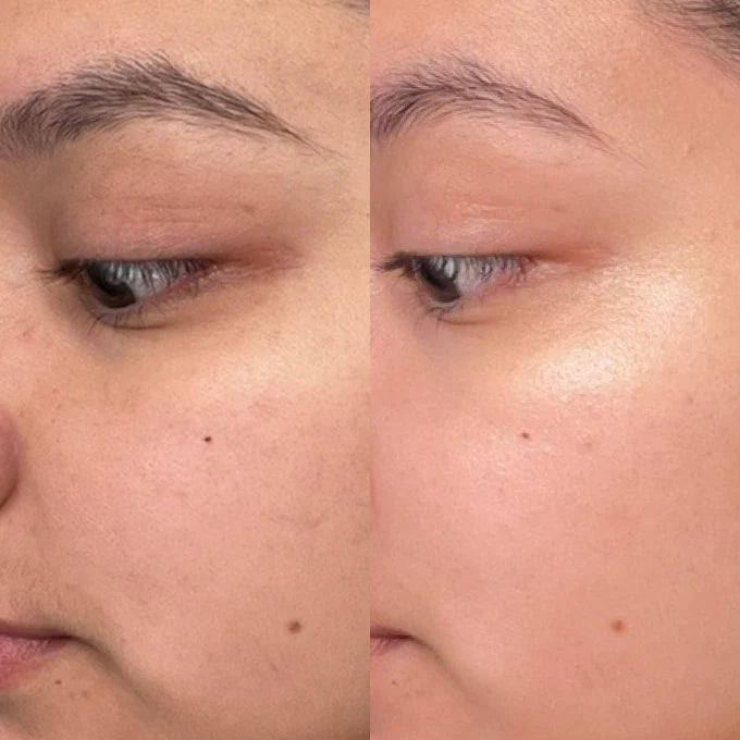 Before and after results