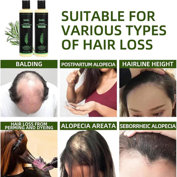 ssiki Rosemary Shampoo-zd