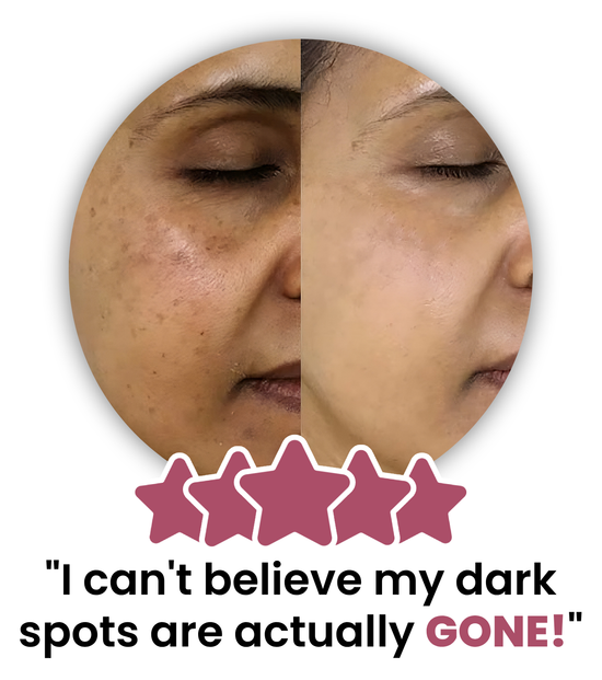 Samia_before_and_after_photos-transformed_7.png
