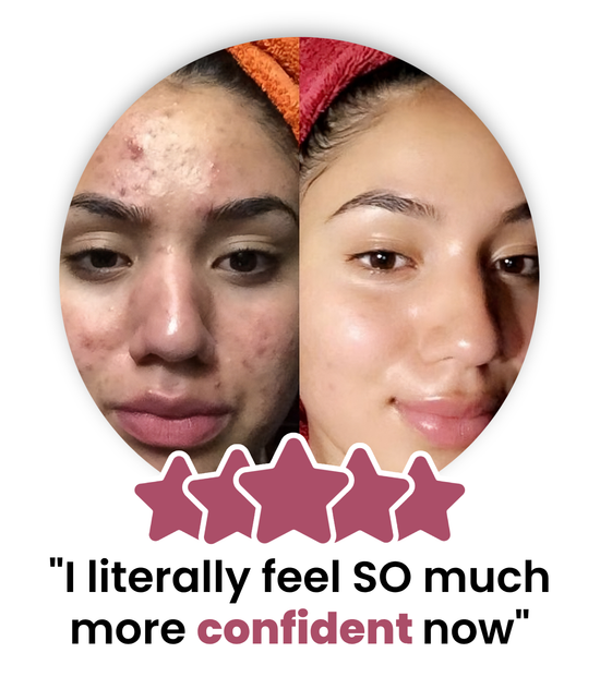 Samia_before_and_after_photos-transformed_8.png