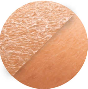 before-after-skin-moisturization-seen-600nw-1497570830.png