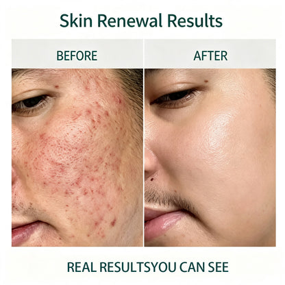 Microcrystal™ Serum PM Duo