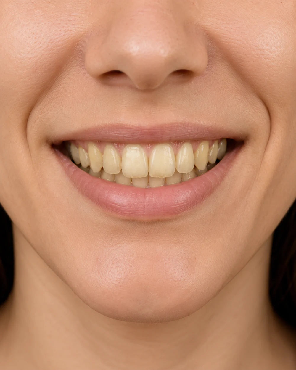 c539c25ccd1c513dce.webp