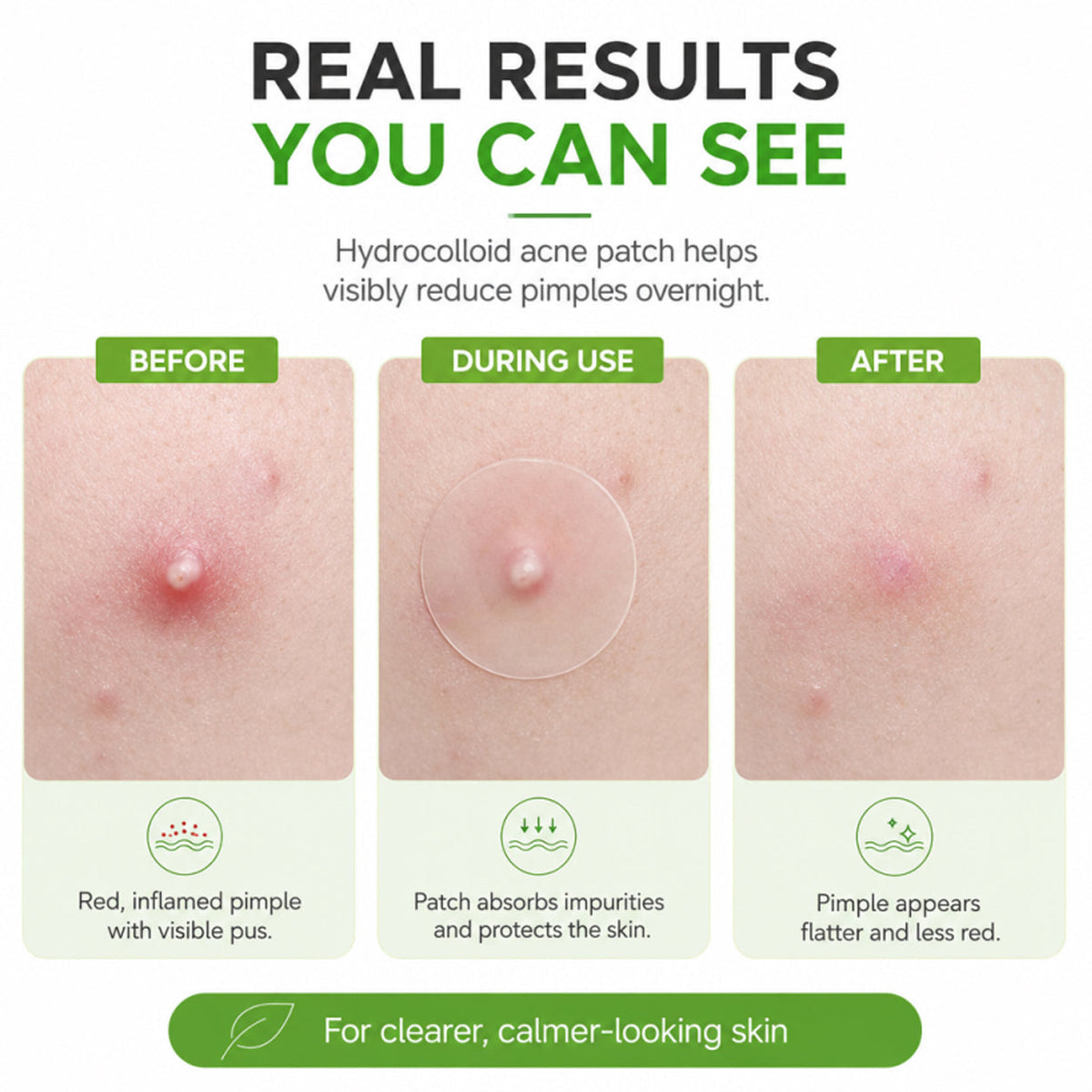 Zero Fit Blemish & Dark Spot Patch Duo