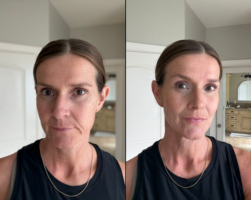 derma_before_after_2_a03a5b5d-ca67-4bbc-b91d-d3f84418eafc.png