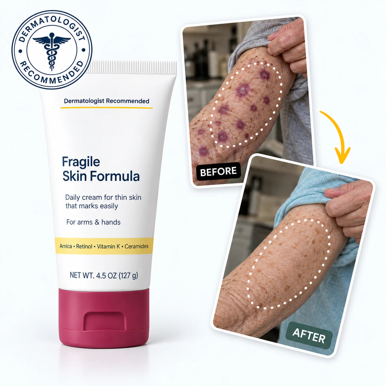  ssiki  Fragile Skin Formula with before-and-after forearm imagery