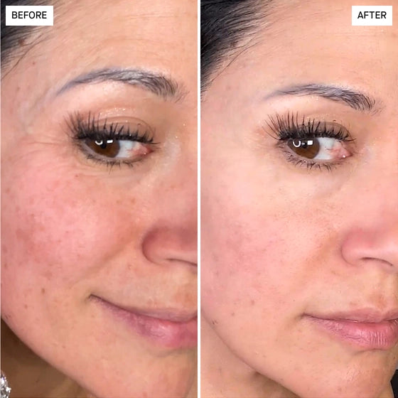 pt-d384bc9147cc-wf-before-after-luxury.webp