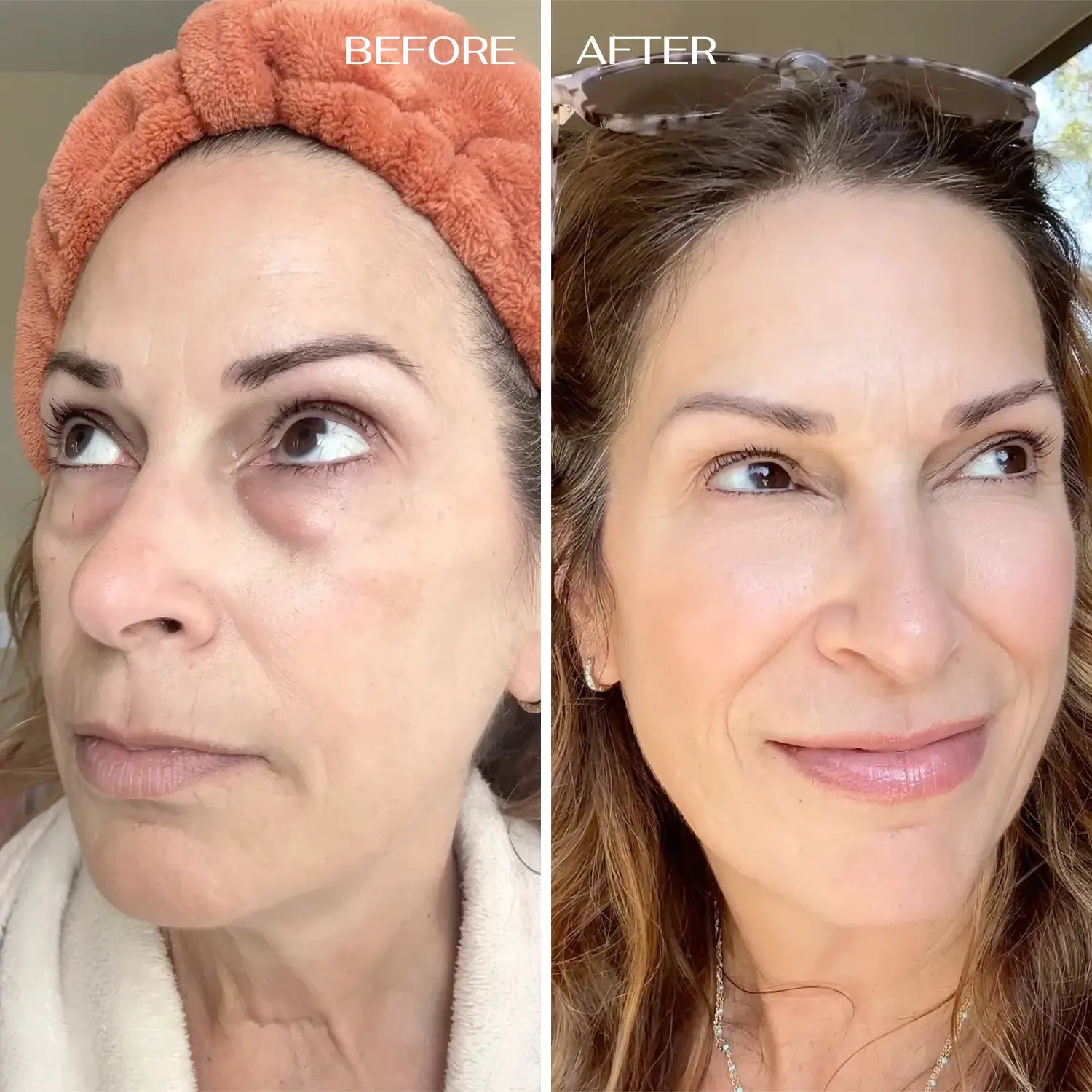 ALL-IN-ONE BALM FOR UNDER EYE RENEWAL✨